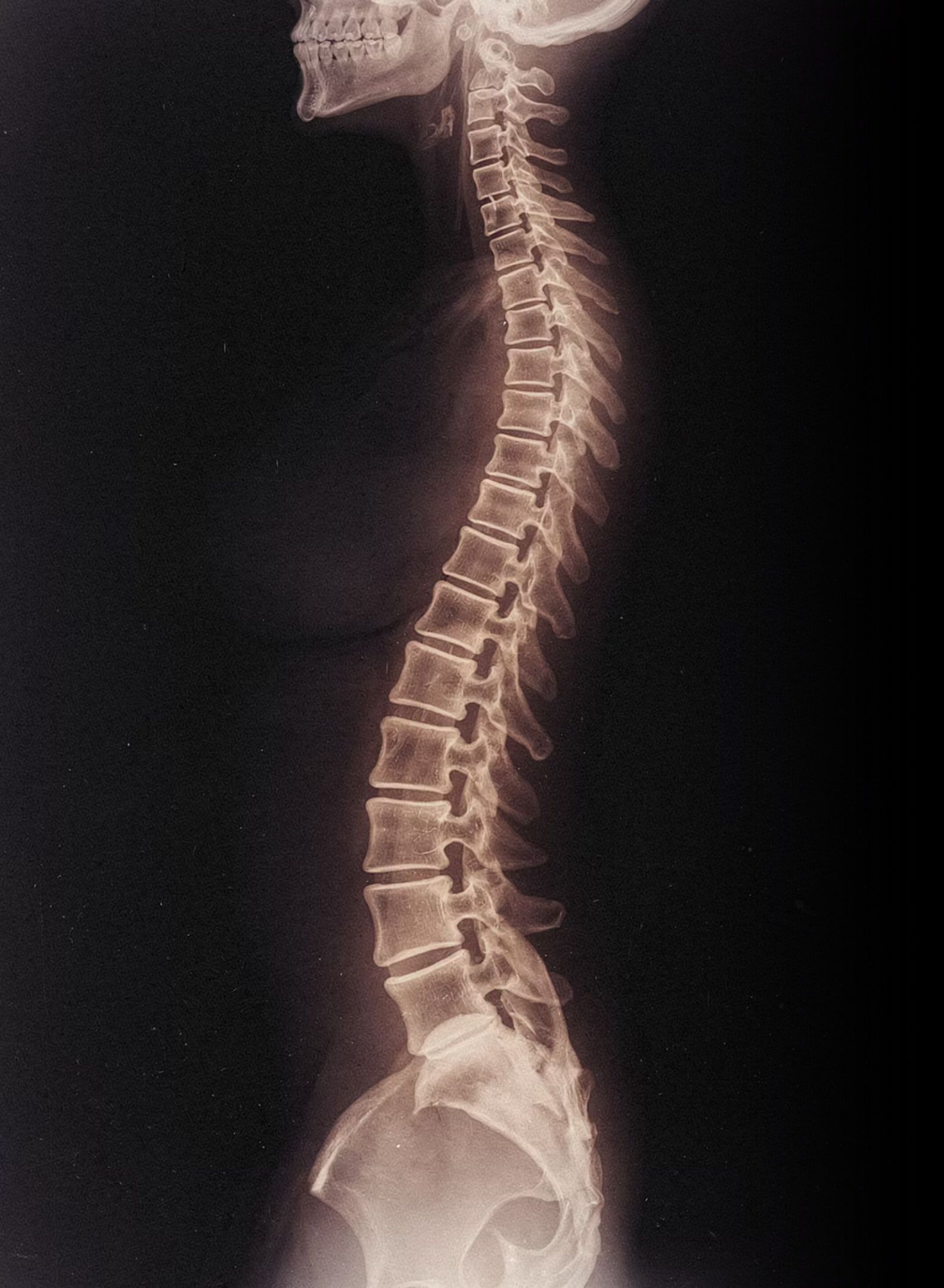 Lateral radiographic view of a full human spine.