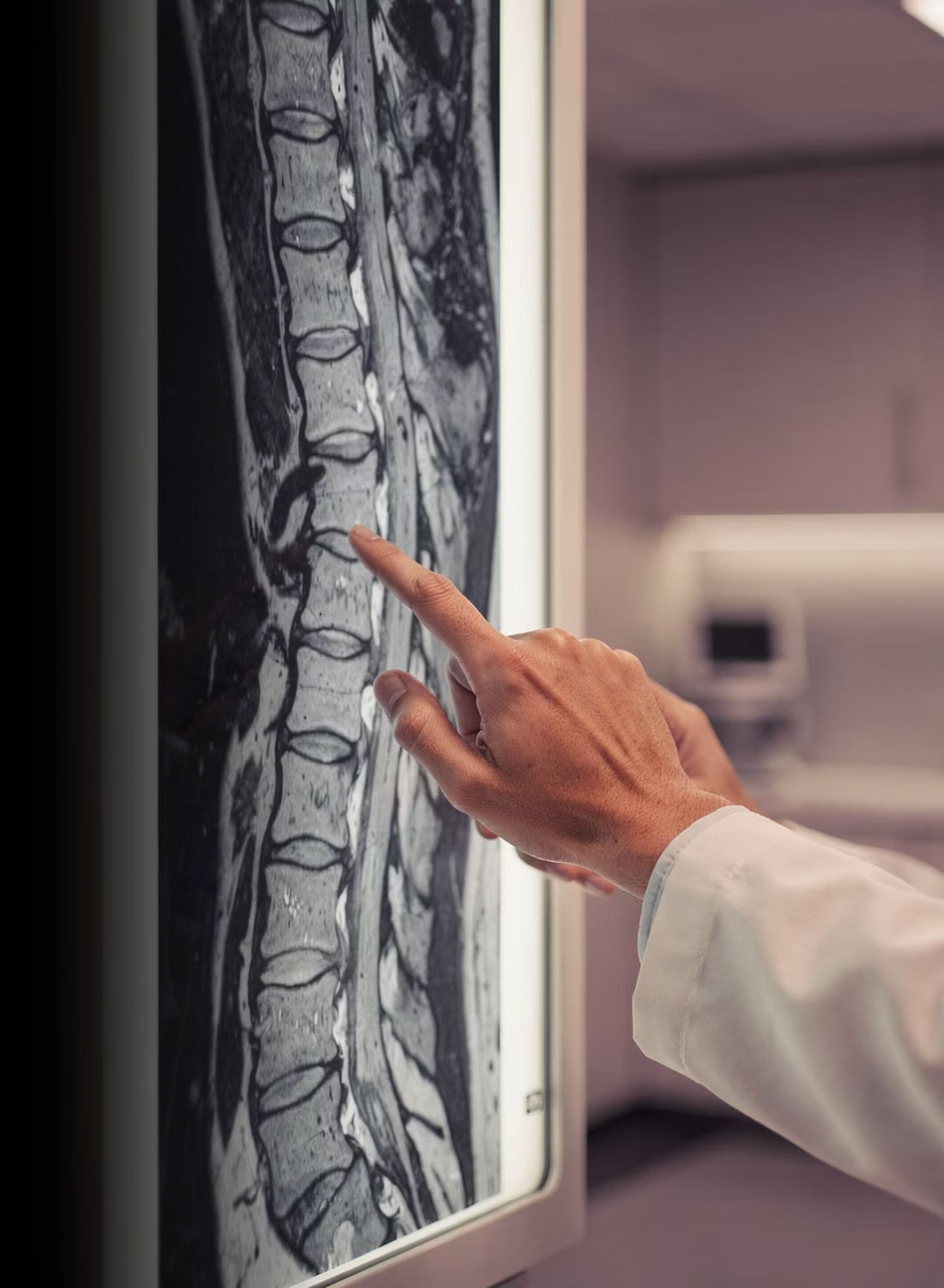 A clinician pointing at a lumbar spine MRI displayed on a lightbox.